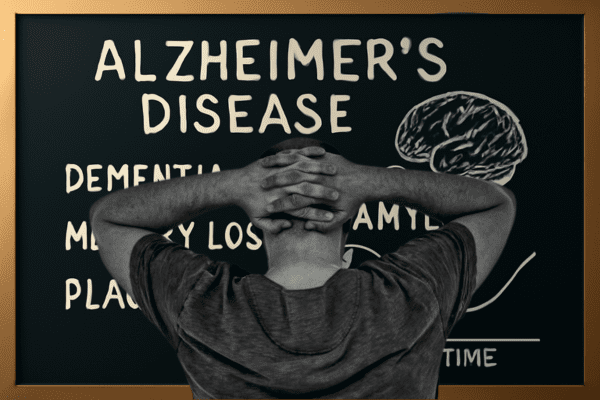 Man looking at a board with Alzheimer’s disease, dementia, and memory loss terms illustrated with a brain drawing.